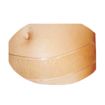 PLACA EM GEL POS CIRURGICO ABDOMINAL 38CM- MODELO TM 508