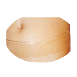 PLACA EM GEL POS CIRURGICO ABDOMINAL 38CM- MODELO TM 508