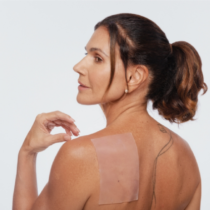 ADESIVOS ANTISSINAIS DE SILICONE PARA TRATAMENTO DE CICATRIZES SUPERBIA  