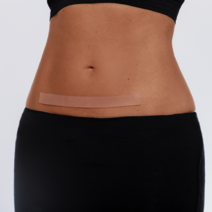 Adesivos Antissinais | Fitas de Silicone para Tratamento de Cicatrizes Superbia
