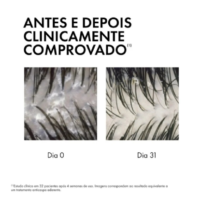 VICHY DERCOS ANTICASPA SERUM 10 93G